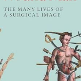 Download (BOOKFILE) Wound Man: The Many 